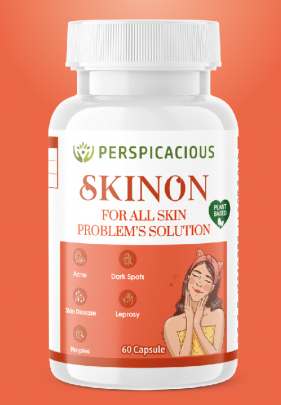 Skinon